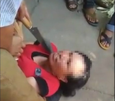 Dí dao vào cổ người phụ nữ 2 lần bị nghi bắt cóc trẻ em - Ảnh 1.