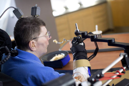 Sau 8 năm bị liệt, ông Bill Kochevar giờ đây có thể di chuyển cánh tay nhờ công nghệ điều khiển bằng suy nghĩ Ảnh: NPR