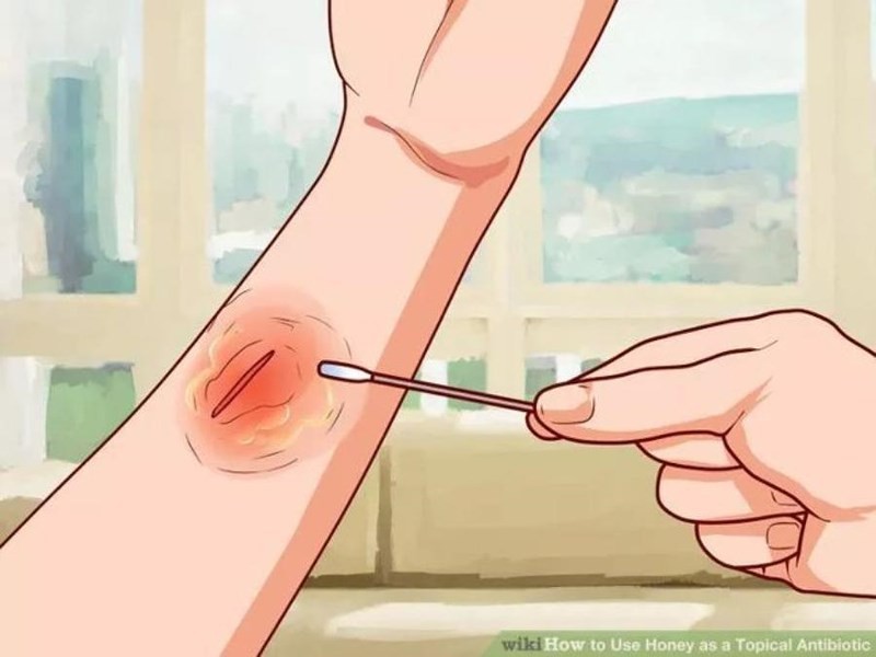 Muốn mau lành vết thương, chế độ dinh dưỡng ra sao?