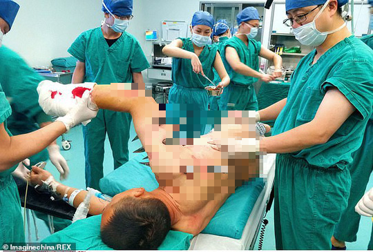 Công nhân Trung Quốc bị robot xiên 10 đinh thép khắp cơ thể - Ảnh 1.