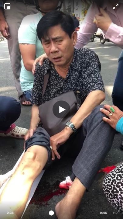 Nhạc sĩ Minh Tâm – em trai cố NSND Thanh Tòng bị tai nạn gãy chân cần sự giúp đỡ - Ảnh 1.