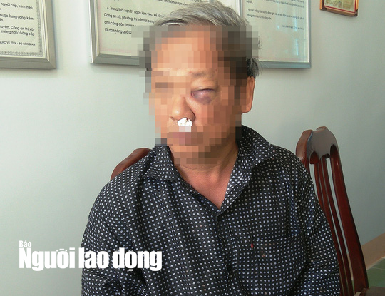 Chủ tịch tỉnh Kon Tum yêu cầu xử lý nghiêm vụ hành hung phóng viên VTV - Ảnh 2.