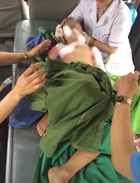 Bé trai 7 tuổi ở Thái Nguyên bị chó nhà nuôi cắn tử vong - Ảnh 1.