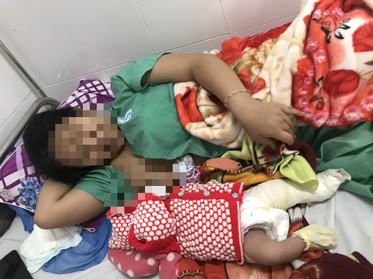Bệnh viện Đa khoa Quảng Nam báo cáo việc bé trai gãy chân khi sinh mổ - Ảnh 2.