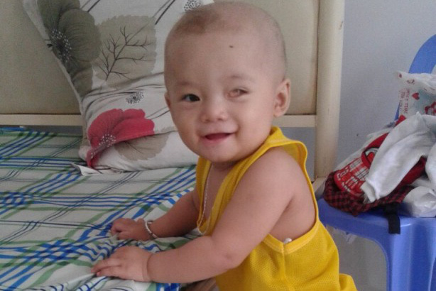 B&eacute; trai su&yacute;t m&ugrave; 2 mắt, được B&aacute;o Người Lao Động gi&uacute;p đỡ giờ ra sao? - Ảnh 2.