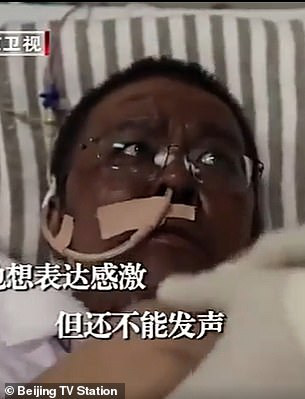 Bác sĩ Trung Quốc bị đổi màu da vì Covid-19 qua đời sau gần 5 tháng điều trị - Ảnh 2.