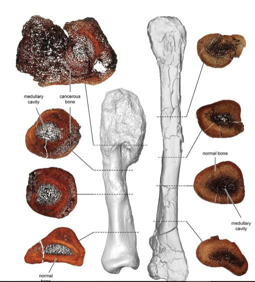 Khủng long cũng bị ung thư ác tính với khối u 76 triệu năm tuổi - Ảnh 3.