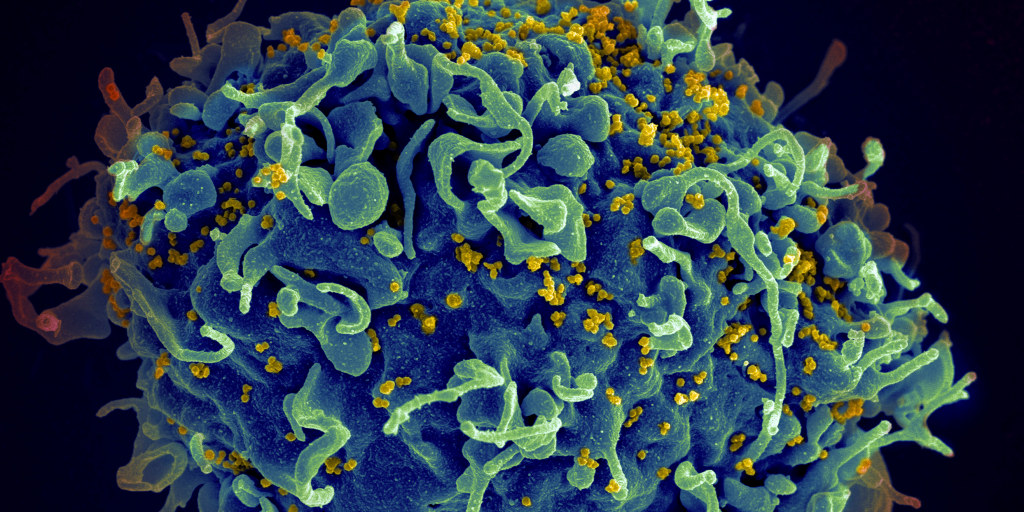 Kỳ diệu người phụ nữ tự loại bỏ HIV - Ảnh 1. Kỳ diệu người phụ nữ tự loại bỏ HIV - Ảnh 1.