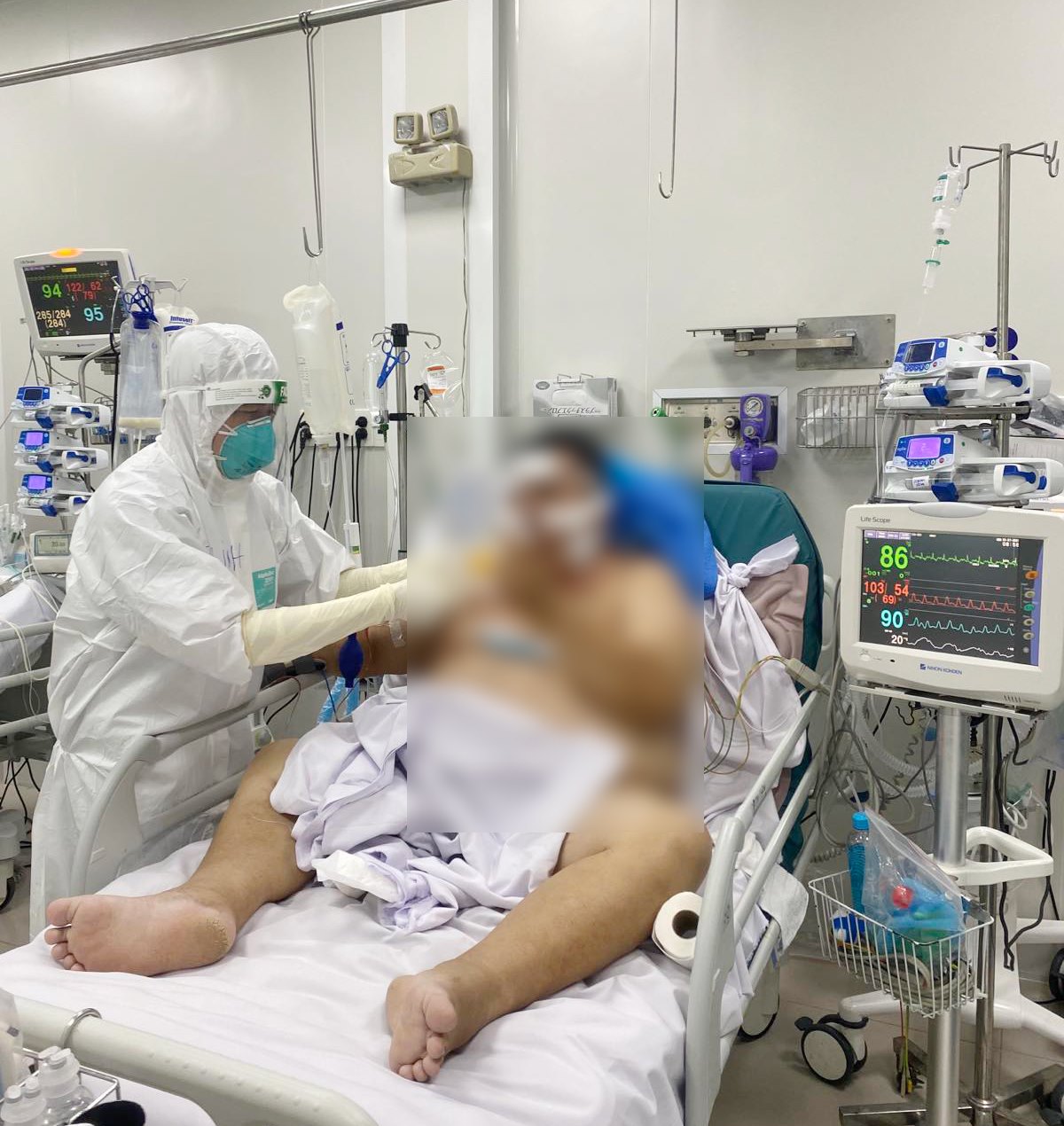 TP HCM: Cứu sống 2 bệnh nhân Covid-19 nguy kịch - Ảnh 1.