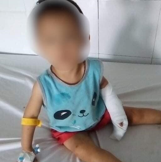 Cháu bé 3 tuổi bị gã đàn ông dùng dao lam cắt cổ tay - Ảnh 2.