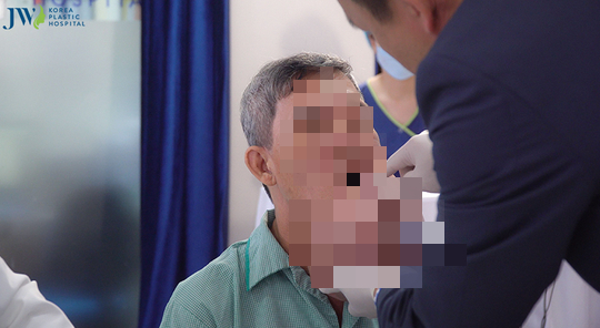 Experts from the US to consult a 10-year case with a giant teratoma on the face - Photo 2.