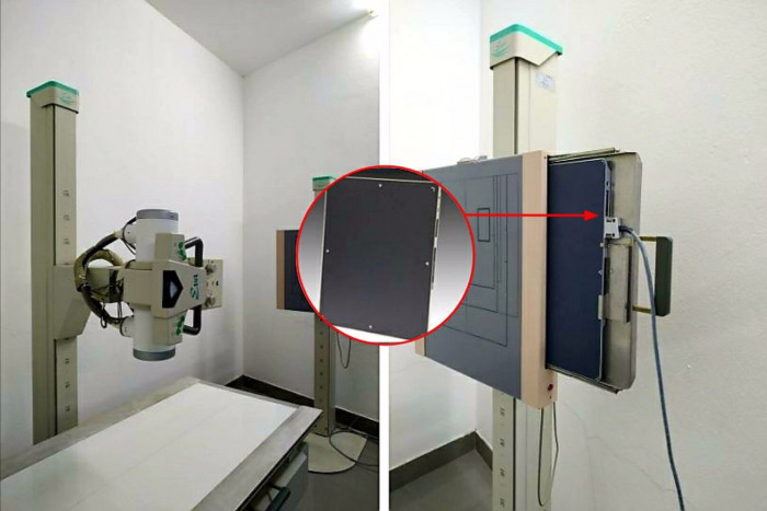 Hàng loạt trung tâm y tế ở Bình Dương, TP HCM bị trộm đột nhập tháo máy X-quang - Ảnh 2. Hàng loạt trung tâm y tế ở Bình Dương, TP HCM bị trộm đột nhập tháo máy X-quang - Ảnh 2.