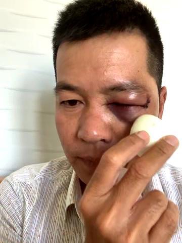 Không khởi tố vụ đánh người dã man trong quầy thuốc tây ở Bình Định - Ảnh 1.