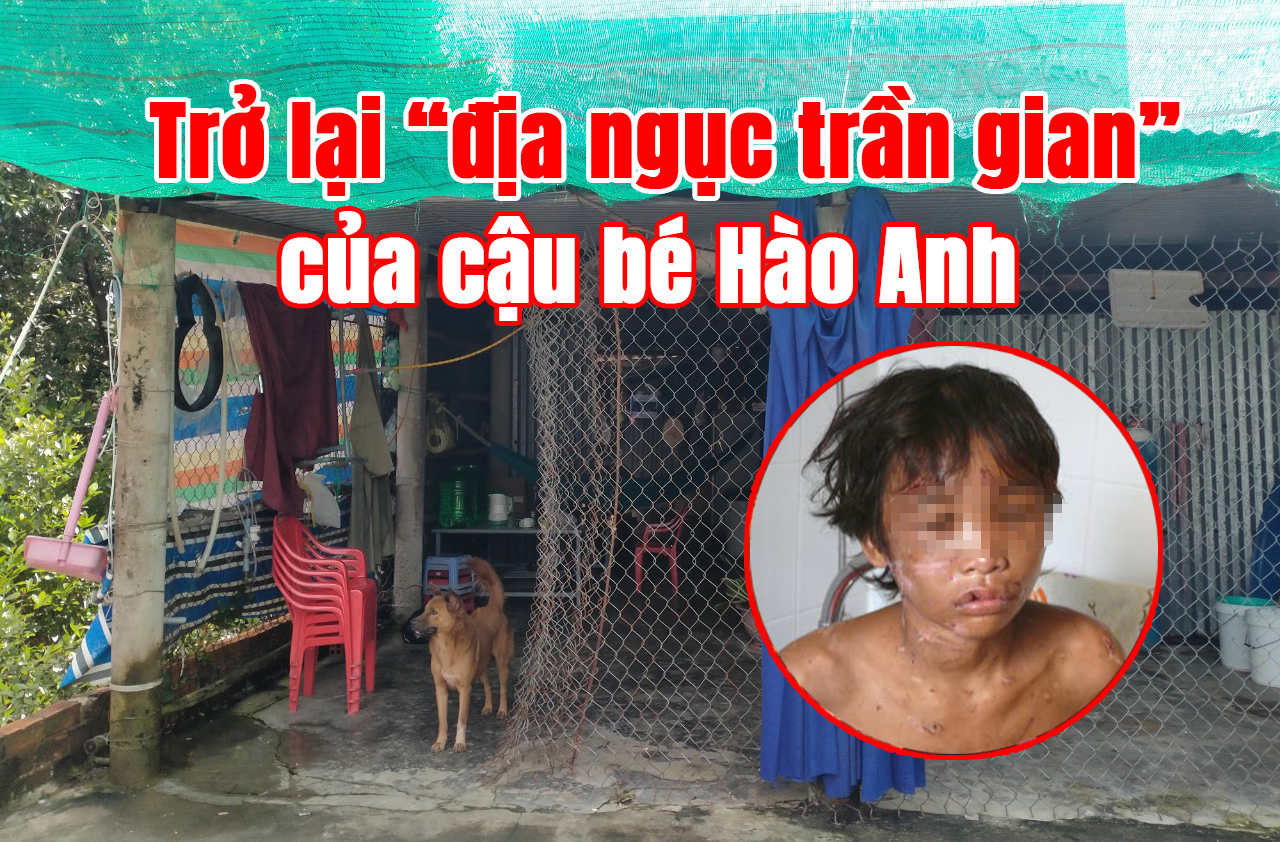 Trở lại “địa ngục trần gian” của cậu bé Hào Anh - Ảnh 1.