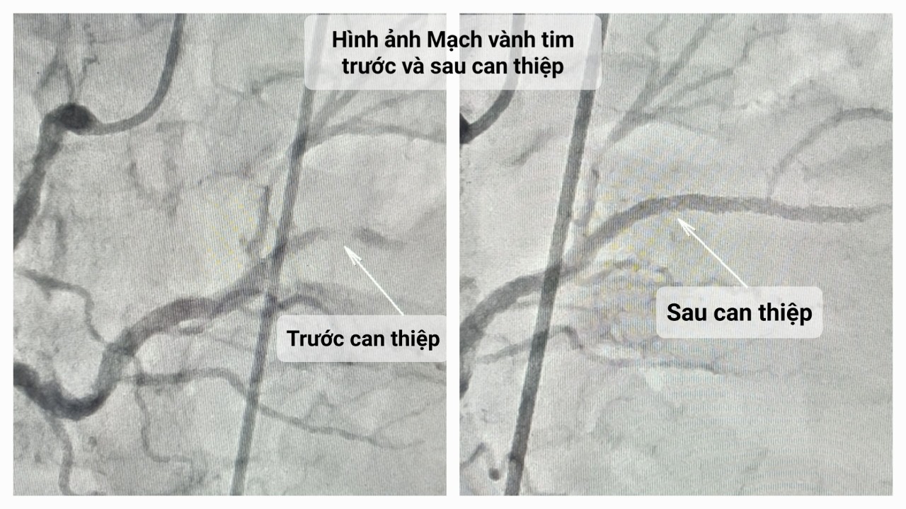 Một người ở TP HCM ngưng tim trên đường đến bệnh viện được cứu sống  - Ảnh 1.