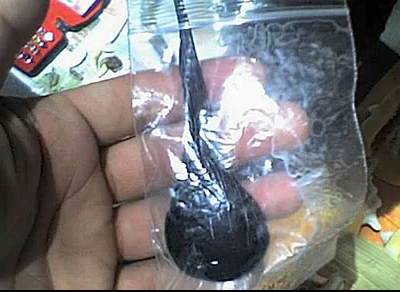 Uống mật cá trắm để tăng sinh lực, người đàn ông 38 tuổi nguy kịch - Ảnh 2.