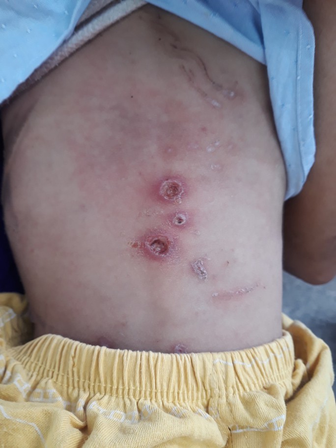 Bé trai 2 tuổi nghi bạo hành hiện ra sao? - Ảnh 1. Bé trai 2 tuổi nghi bạo hành hiện ra sao? - Ảnh 1.