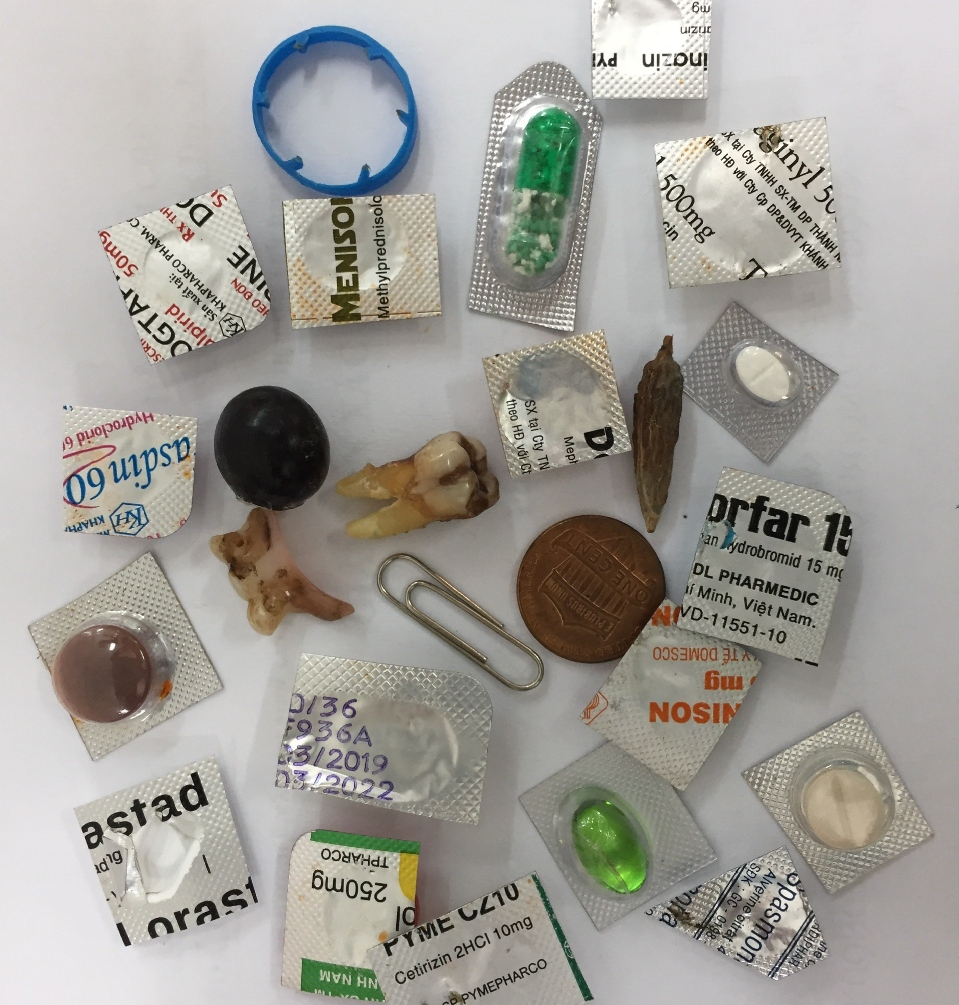 Bác sĩ nội soi sửng sốt vì một đống rác hỗn độn trong bao tử nam thanh niên - Ảnh 2. Bác sĩ nội soi sửng sốt vì một đống rác hỗn độn trong bao tử nam thanh niên - Ảnh 2.