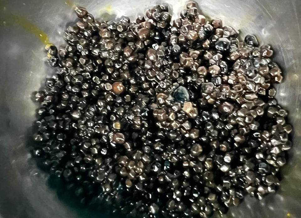 Người phụ nữ tích hàng ngàn viên sỏi mật trong cơ thể - Ảnh 1. Người phụ nữ tích hàng ngàn viên sỏi mật trong cơ thể - Ảnh 1.