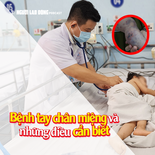 Làm sao để biết trẻ mắc bệnh tay chân miệng?