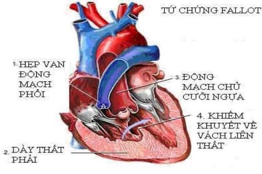 Cứu mạng bệnh nhân bằng kỹ thuật y khoa đỉnh cao- Ảnh 16.