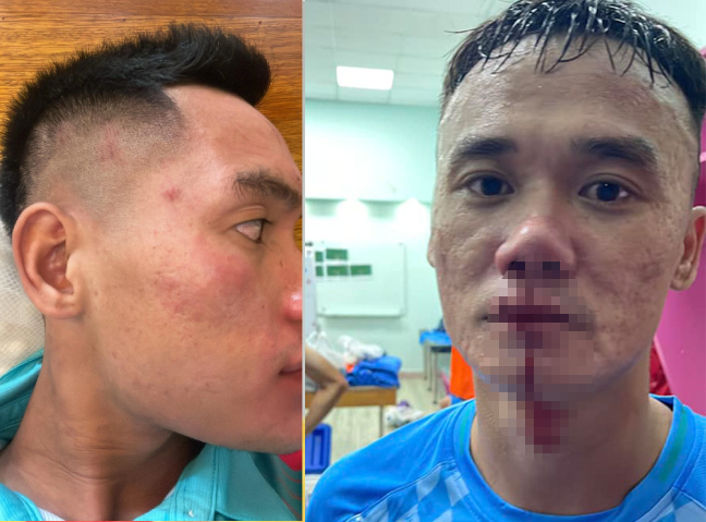 VPF solicita punição rigorosa por conduta antidesportiva na partida PVF-CAND - Ho Chi Minh City Youth - Foto 2. VPF yêu cầu xử nghiêm hành vi phi thể thao ở trận đấu PVF-CAND - Trẻ TP HCM- Ảnh 2.