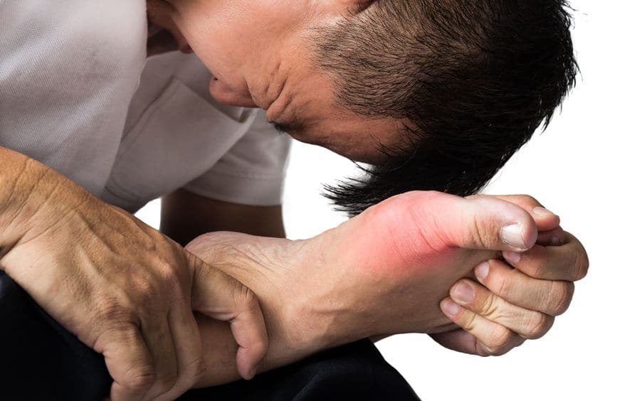 L&agrave;m sao để ngăn ngừa gout cấp t&aacute;i ph&aacute;t? - Ảnh 1.