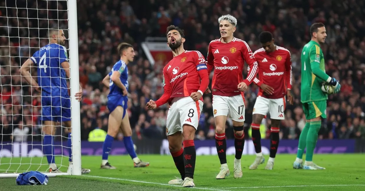 Manchester United sẽ là cuộc đối đầu với Leicester City