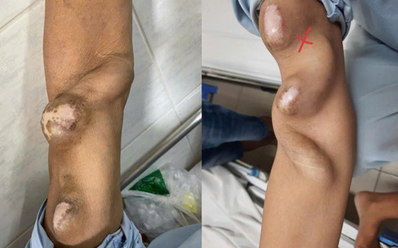 Thận áp lực vì uống nhiều cà phê, trà sữa, nước tăng lực - Ảnh 2.