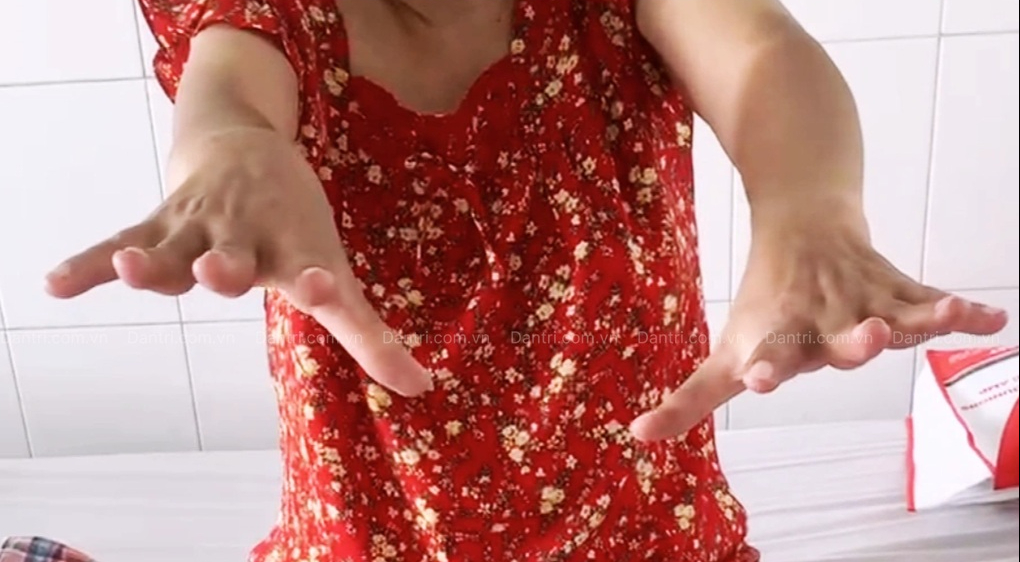 Người phụ nữ ở TP HCM mắc căn bệnh “bí ẩn” suốt 20 năm - Ảnh 1.