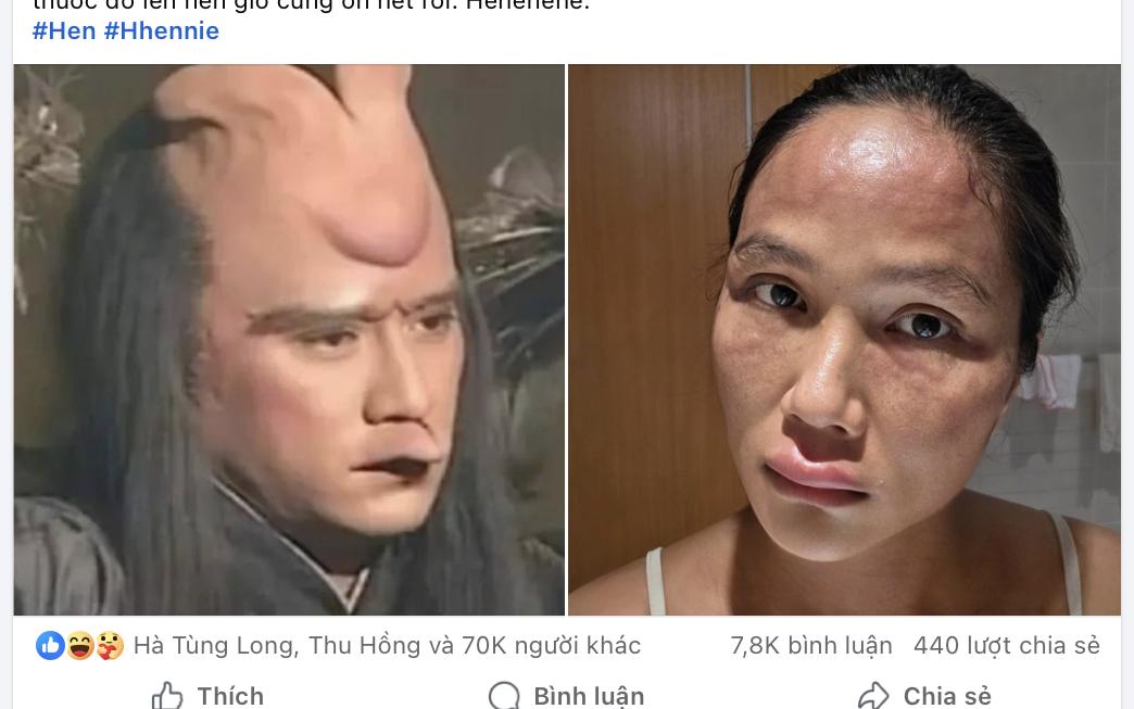 Gương mặt H'hen Niê biến dạng    - Ảnh 2.