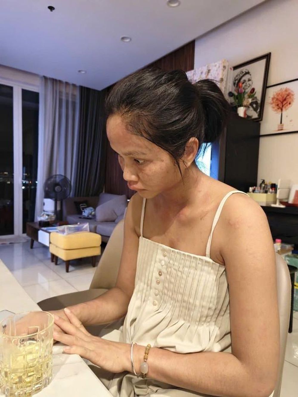 H'hen Niê mắc bệnh sau sinh - Ảnh 2.