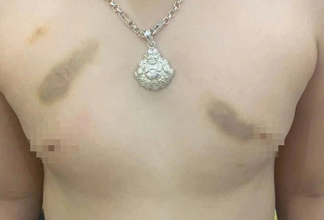 Giáo viên bị xử phạt vì bạo hành trẻ, phụ huynh đòi hoàn lại 1 năm học phí - Ảnh 1.