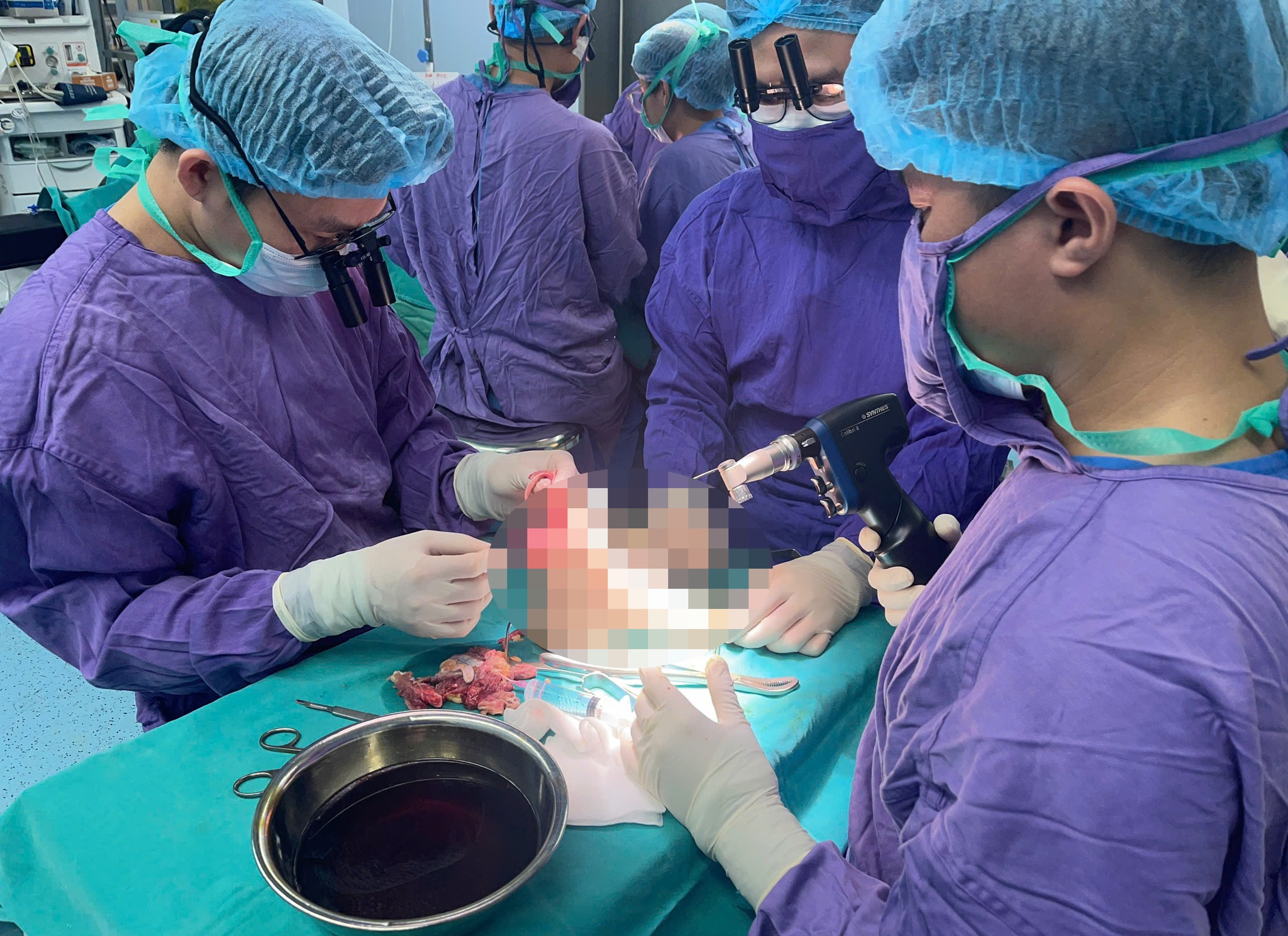 Nối chân đứt rời cho cô gái sau va chạm với mô tô phân khối lớn - Ảnh 1.