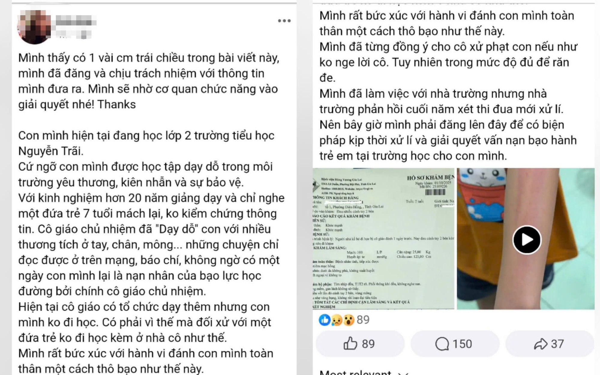 Nhà trường lên tiếng vụ cô giáo đánh học sinh lớp 2 gây xôn xao mạng xã hội - Ảnh 2.