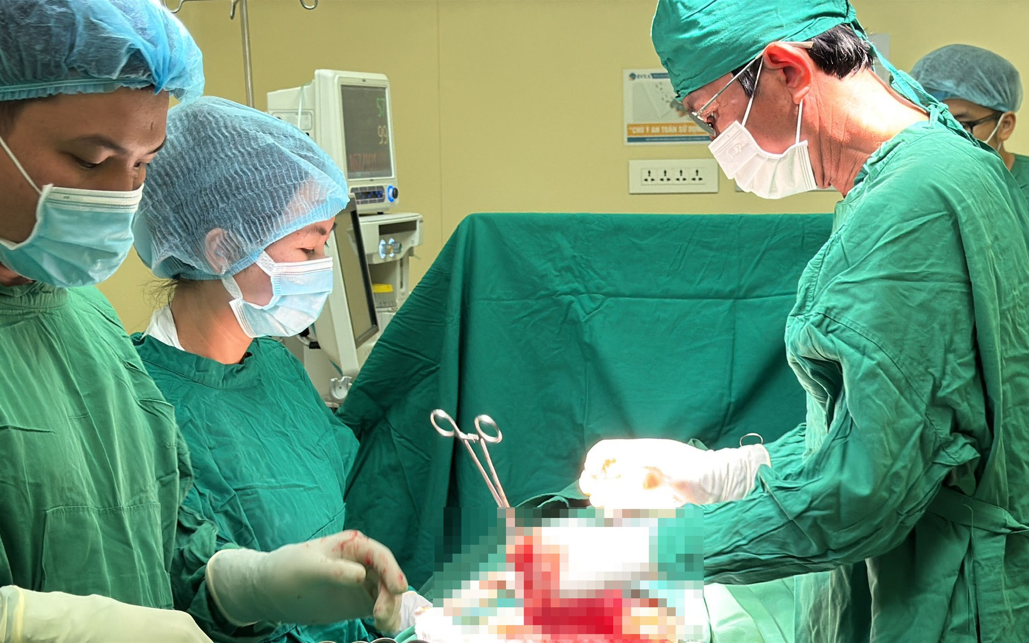 Bóc 18 khối u xơ, bảo toàn tử cung cho bệnh nhân - Ảnh 3.