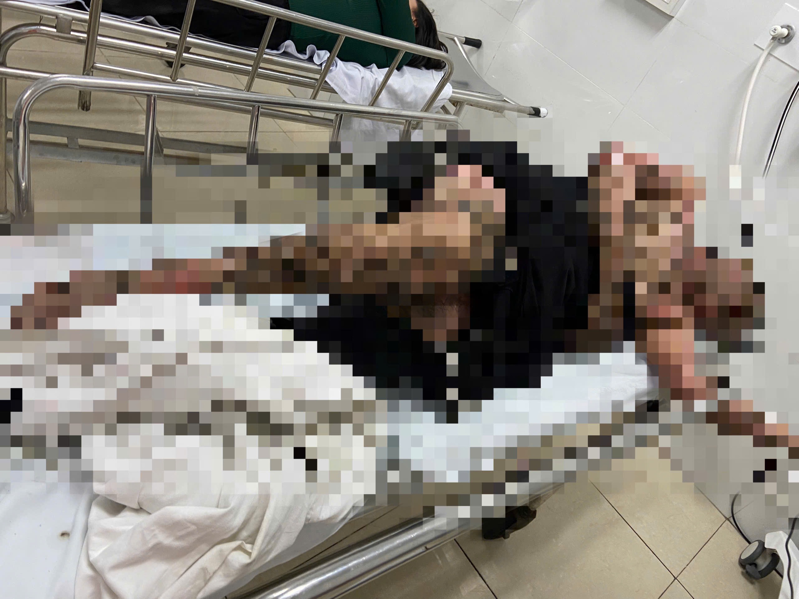 Bị điện giật bỏng nặng khi quăng cần câu vướng dây điện - Ảnh 1.