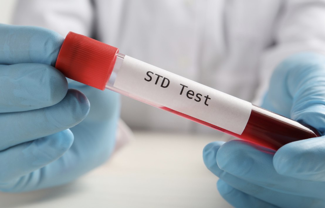 1 bệnh viện ở TP HCM ghi nhận 1 năm hơn 38.000 ca sùi mào gà - Ảnh 1.