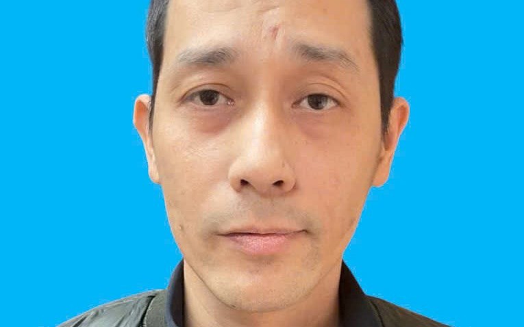 Mâu thuẫn lúc xem đánh cơ tướng, bị đâm thủng gan, phổi - Ảnh 2.