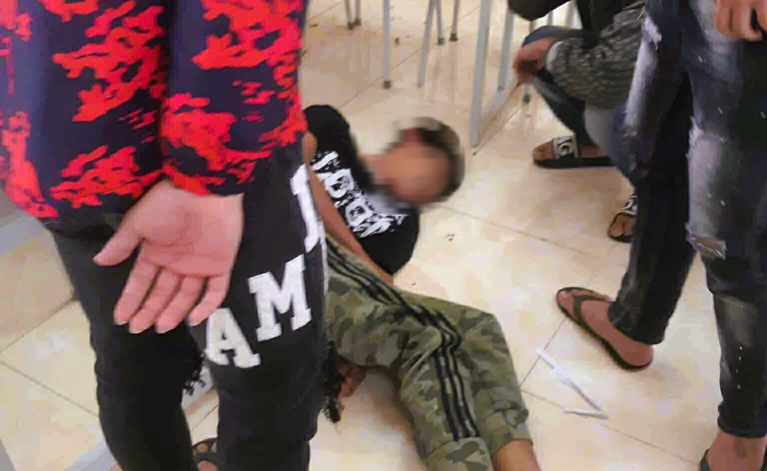 Nam sinh lớp 10 bị nhóm bạn cùng trường đánh dẫn tới chảy máu não - Ảnh 1.