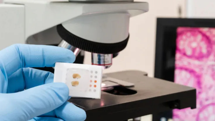 Thêm tiềm năng của AI trong cải thiện điều trị ung thư - Ảnh 1.