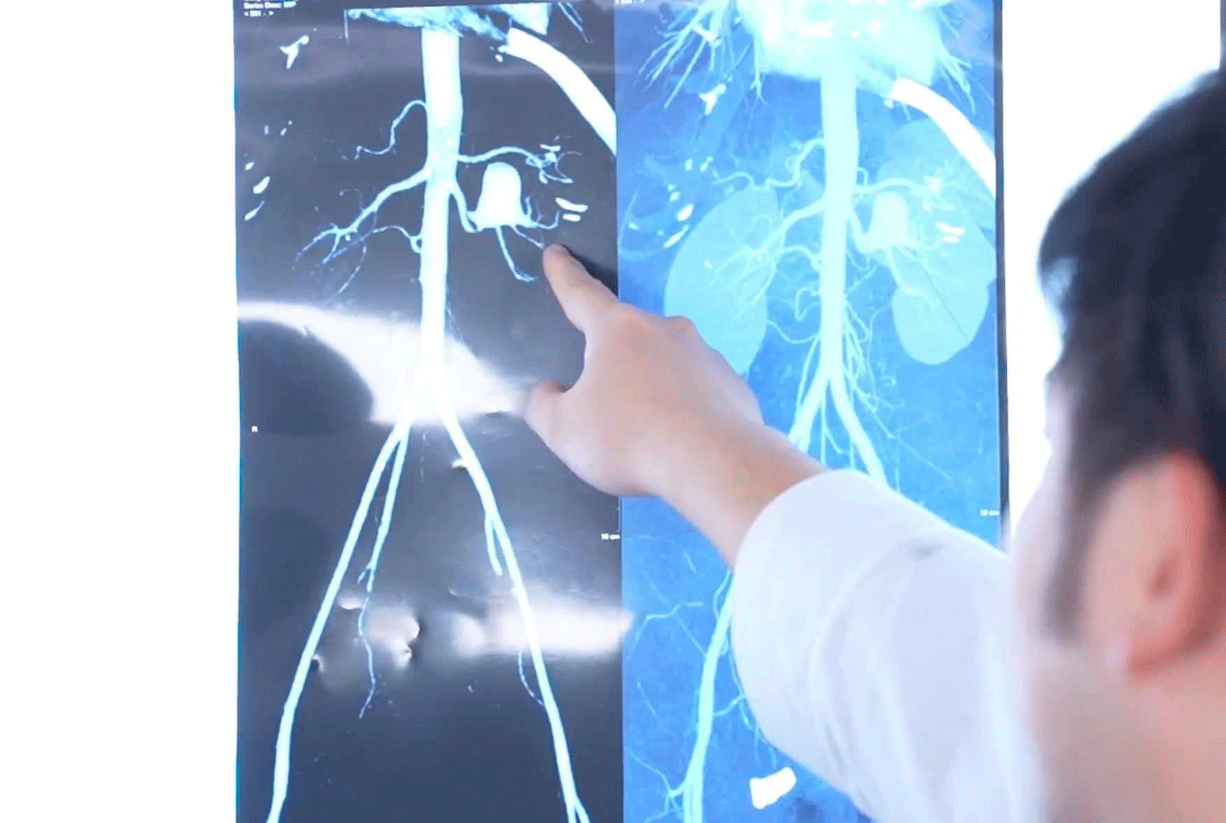 Hai bác sĩ cùng tên và ca mổ lịch sử - Ảnh 1.