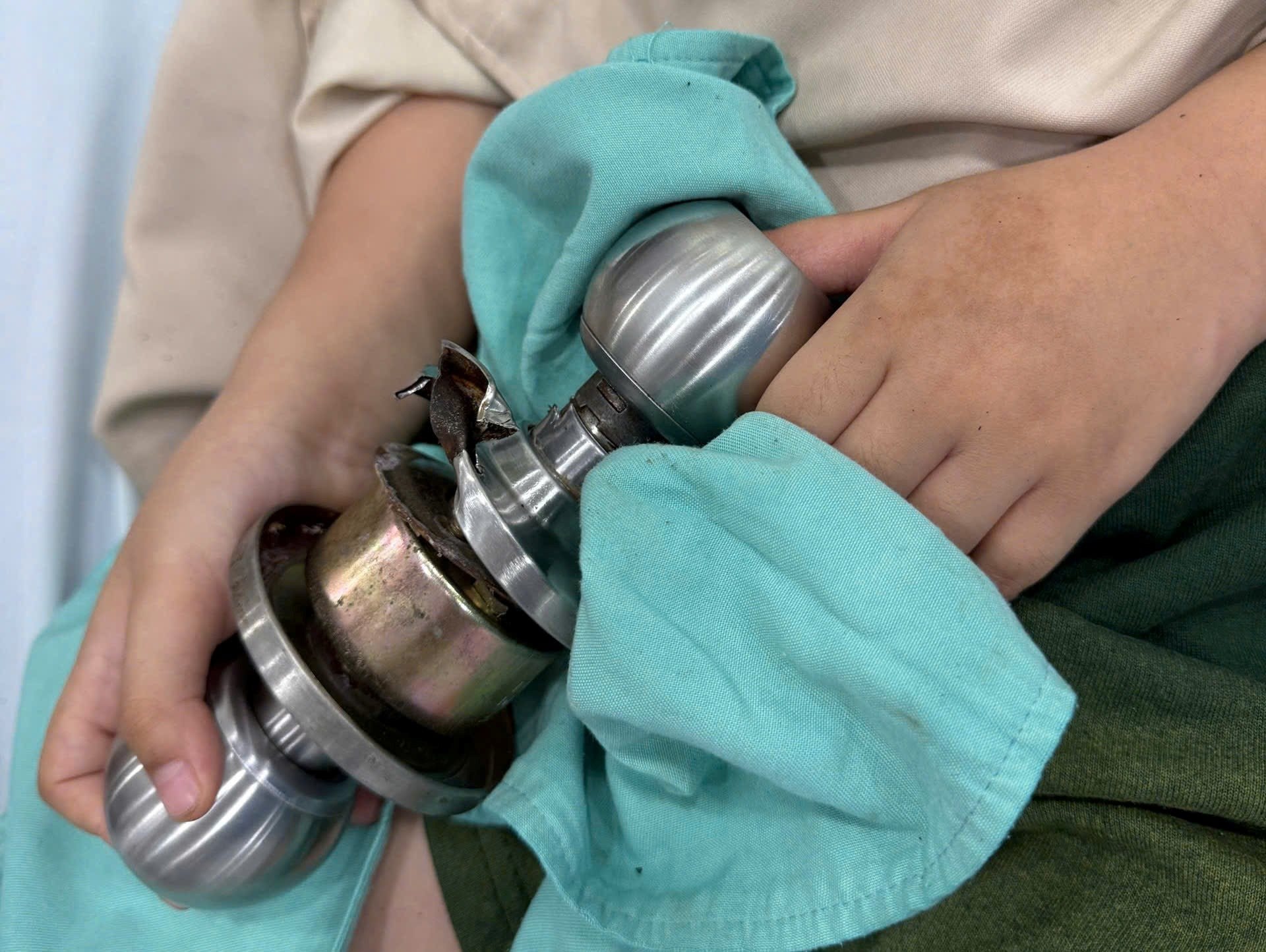 Bé trai 5 tuổi được gia đình đưa đi cấp cứu khi ngón tay vẫn dính chặt vào ổ khóa. - Ảnh 1.