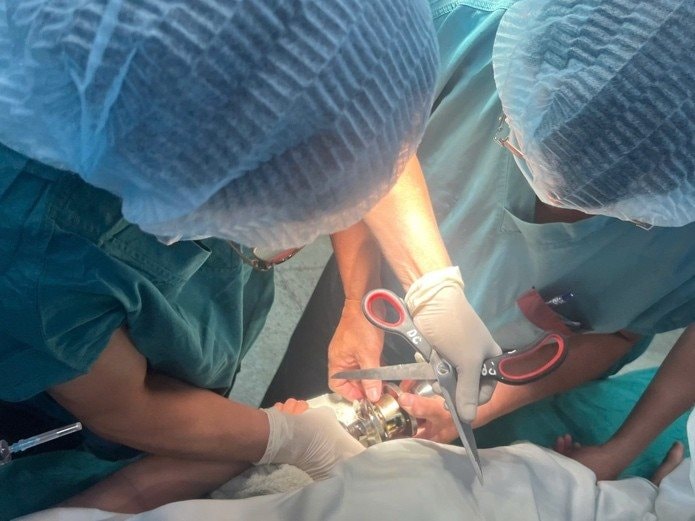 Bé trai 5 tuổi được gia đình đưa đi cấp cứu khi ngón tay vẫn dính chặt vào ổ khóa. - Ảnh 2.