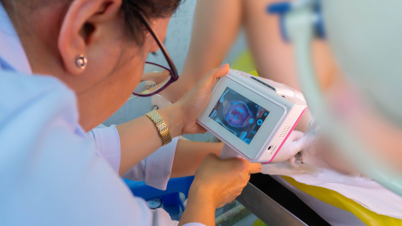 Tầm soát ung thư cổ tử cung bằng AI: 5 phút nhận kết quả thay vì 1 tuần - Ảnh 4.