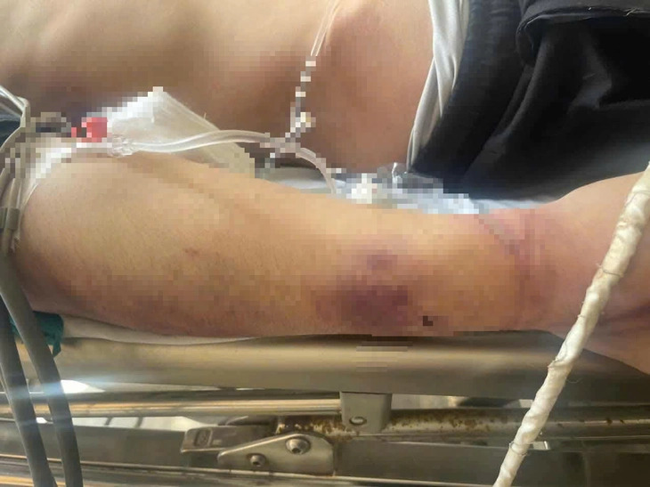 Học viên tử vong sau xô xát tại Trung tâm Công tác xã hội Hải Hà , Quảng Ninh - Ảnh 2.