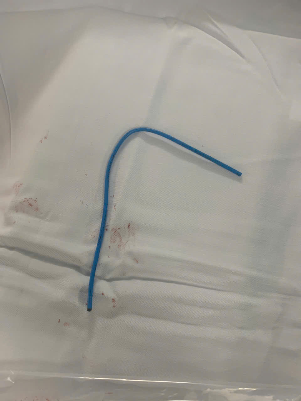 Ống thông truyền hóa chất bị bỏ quên, bị đứt rồi trôi vào tim người phụ nữ - Ảnh 4.