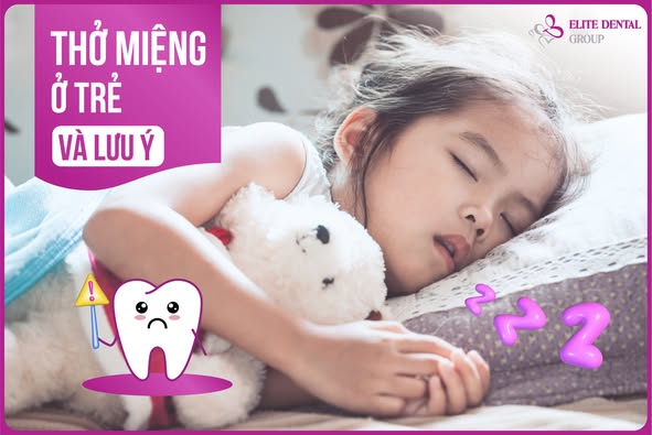 Trẻ thở bằng miệng khi ngủ? Đừng bỏ qua dấu hiệu khiến xương hàm phát triển lệch lạc- Ảnh 3.