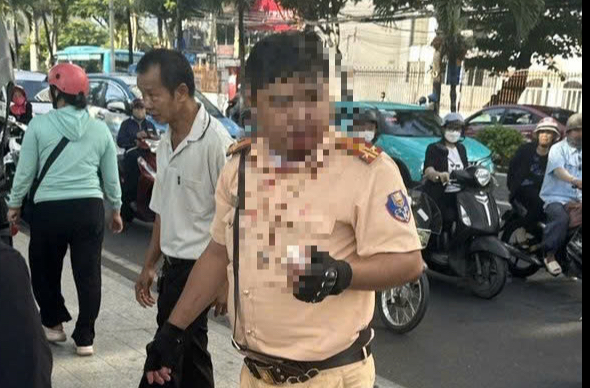 Phân định pháp lý vụ một Trung tá CSGT bị thanh niên người Nga tấn công- Ảnh 1.