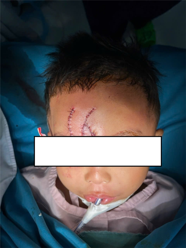 Đang chơi trước nhà bé trai 5 tuổi đột nhiên bị một vật nuôi tấn công - Ảnh 2.